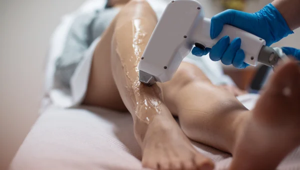 Laser hair removal being performed on a woman's leg