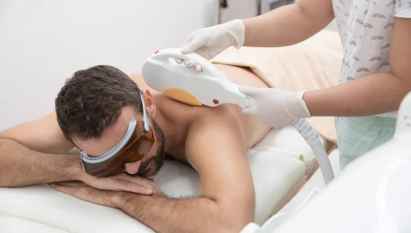 Man receiving laser hair removal on his back while wearing protective glasses