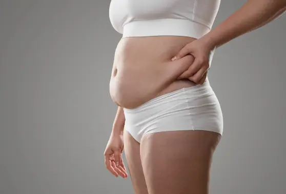 Woman pinching excess fat on her abdomen, highlighting a target area for non-invasive fat reduction.