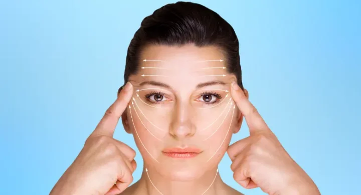 Woman touching face with lifting lines showing facial rejuvenation